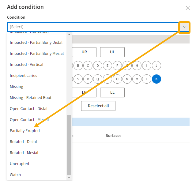 Add Condition Window with yellow highlight box around the drop down arrow and a yellow arrow pointing downwards to partially erupted option.